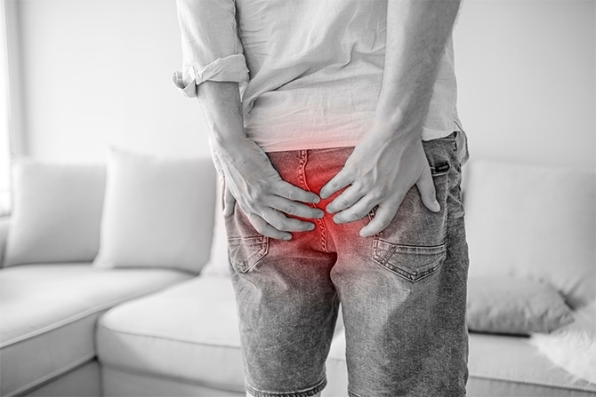 Hemorrhoids